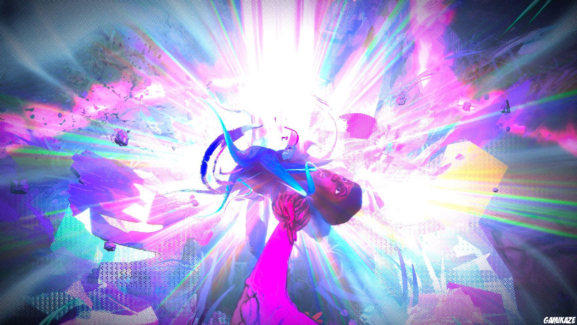 RAD