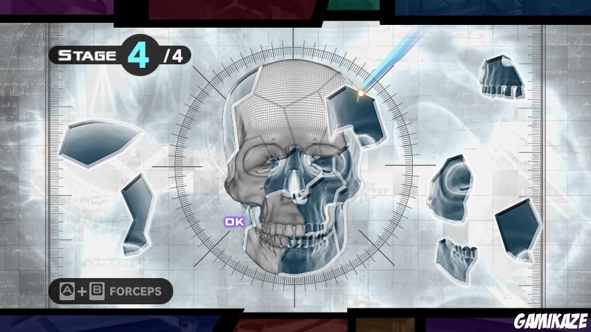 Trauma Team